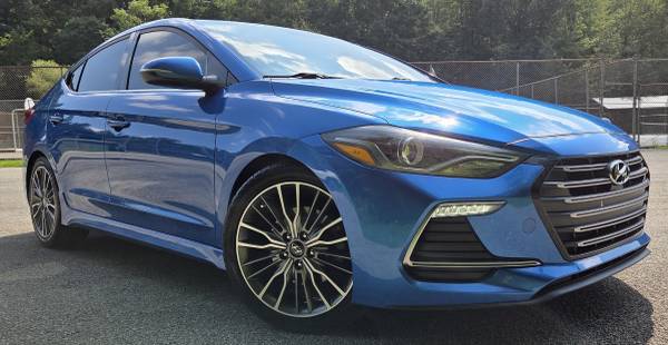 2018 Hyundai Elantra SEL — photo 2