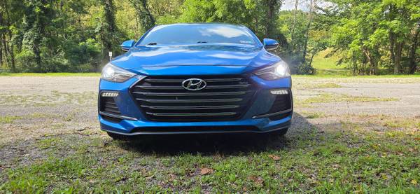 2018 Hyundai Elantra SEL — photo 5