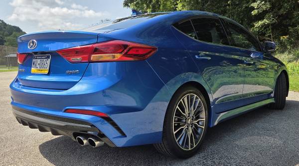 2018 Hyundai Elantra SEL — photo 3