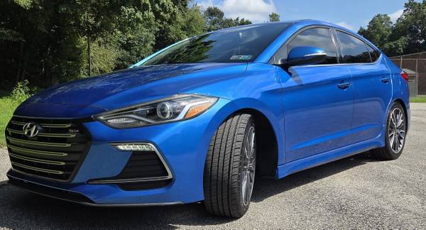 2018 Hyundai Elantra SEL — photo 1
