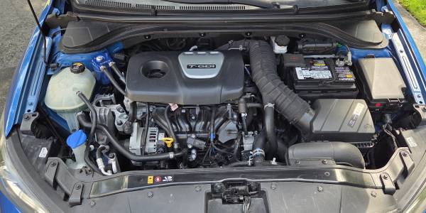 2018 Hyundai Elantra SEL — photo 8